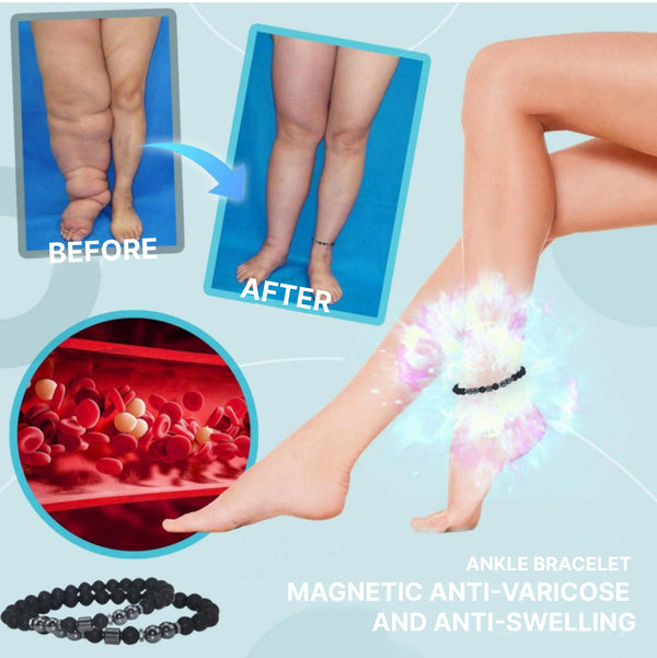 Magnetic Anklet Anti-Varice and Anti-Swelling