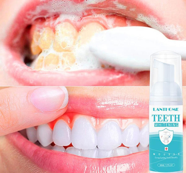 Teeth Whitening Foam - WhiteCare