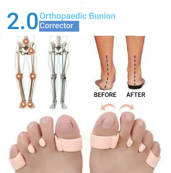Orthopaedic Bunion Corrector